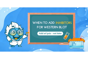 When to Add Protease and Phosphatase Inhibitors for Western Blot
