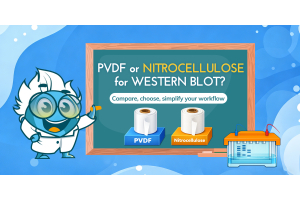 Which Membrane Should You Choose for Western Blot