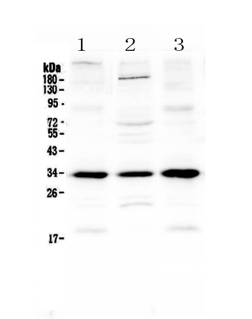 Figure 1. Western blot analysis of MyD88 using anti-MyD88 antibody (A00025-1). Electrophoresis was performed on a 5-20% SDS-PAGE gel at 70V (Stacking gel) / 90V (Resolving gel) for 2-3 hours. The sample well of each lane was loaded with 50ug of sample under reducing conditions. Lane 1: mouse spleen tissue lysates, Lane 2: mouse testis tissue lysates, Lane 3: rat spleen tissue lysates. After Electrophoresis, proteins were transferred to a Nitrocellulose membrane at 150mA for 50-90 minutes. Blocked the membrane with 5% Non-fat Milk/ TBS for 1.5 hour at RT. The membrane was incubated with rabbit anti-MyD88 antigen affinity purified polyclonal antibody (Catalog # A00025-1) at 0.5 ug/mL overnight at 4 then washed with TBS-0.1%Tween 3 times with 5 minutes each and probed with a goat anti-rabbit IgG-HRP secondary antibody at a dilution of 1:10000 for 1.5 hour at RT. The signal is developed using an Enhanced Chemiluminescent detection (ECL) kit (Catalog # EK1002) with Tanon 5200 system. A specific band was detected for MyD88 at approximately 33KD. The expected band size for MyD88 is at 33KD.