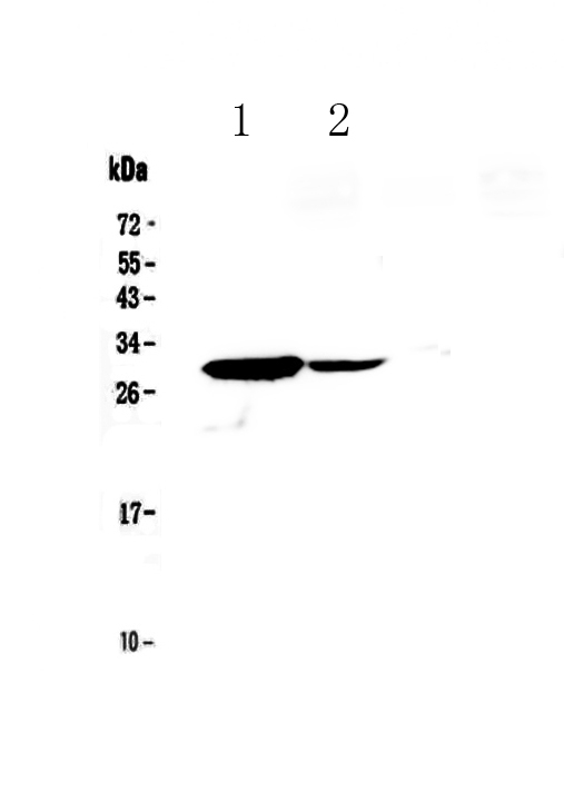 Western blot analysis of IL17C using anti-IL17C antibody (A00164-2).