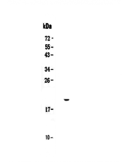 Western blot analysis of IL17C using anti-IL17C antibody (A00164-3).