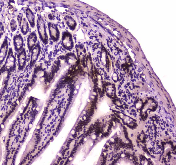 Figure 3. IHC analysis of BRG1 using anti-BRG1 antibody (A00223-1). BRG1 was detected in paraffin-embedded section of mouse small intestine tissue. Heat mediated antigen retrieval was performed in citrate buffer (pH6, epitope retrieval solution) for 20 mins. The tissue section was blocked with 10% goat serum. The tissue section was then incubated with 2microg/ml rabbit anti-BRG1 Antibody (A00223-1) overnight at 4°C. Biotinylated goat anti-rabbit IgG was used as secondary antibody and incubated for 30 minutes at 37°C. The tissue section was developed using Strepavidin-Biotin-Complex (SABC)(Catalog # SA1022) with DAB as the chromogen.