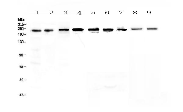 Figure 1. Western blot analysis of BRG1 using anti-BRG1 antibody (A00223-1). Electrophoresis was performed on a 5-20% SDS-PAGE gel at 70V (Stacking gel) / 90V (Resolving gel) for 2-3 hours. The sample well of each lane was loaded with 50ug of sample under reducing conditions. Lane 1: human Hela whole cell lysates, Lane 2: human placenta tissue lysates, Lane 3: human MCF-7 whole cell lysates, Lane 4: human A549 whole cell lysates, Lane 5: human A431 whole cell lysates, Lane 6: human SGC-7901 whole cell lysates, Lane 7: human 22RV1 whole cell lysates, Lane 8: rat small intestine tissue lysates, Lane 9: mouse small intestine tissue lysates. After Electrophoresis, proteins were transferred to a Nitrocellulose membrane at 150mA for 50-90 minutes. Blocked the membrane with 5% Non-fat Milk/ TBS for 1.5 hour at RT. The membrane was incubated with rabbit anti-BRG1 antigen affinity purified polyclonal antibody (Catalog # A00223-1) at 0.5 microg/mL overnight at 4°C, then washed with TBS-0.1%Tween 3 times with 5 minutes each and probed with a goat anti-rabbit IgG-HRP secondary antibody at a dilution of 1:10000 for 1.5 hour at RT. The signal is developed using an Enhanced Chemiluminescent detection (ECL) kit (Catalog # EK1002) with Tanon 5200 system. A specific band was detected for BRG1 at approximately 220KD. The expected band size for BRG1 is at 185KD.