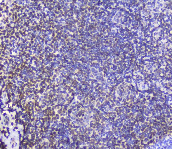 Figure 5. IHC analysis of AHR using anti-AHR antibody (A00225-2). AHR was detected in paraffin-embedded section of human tonsil tissue. Heat mediated antigen retrieval was performed in citrate buffer (pH6, epitope retrieval solution) for 20 mins. The tissue section was blocked with 10% goat serum. The tissue section was then incubated with 2microg/ml rabbit anti-AHR Antibody (A00225-2) overnight at 4°C. Biotinylated goat anti-rabbit IgG was used as secondary antibody and incubated for 30 minutes at 37°C. The tissue section was developed using Strepavidin-Biotin-Complex (SABC)(Catalog # SA1022) with DAB as the chromogen. Figure 5. IHC analysis of AHR using anti-AHR antibody (A00225-2). AHR was detected in paraffin-embedded section of human tonsil tissue. Heat mediated antigen retrieval was performed in citrate buffer (pH6, epitope retrieval solution) for 20 mins. The tissue section was blocked with 10% goat serum. The tissue section was then incubated with 2microg/ml rabbit anti-AHR Antibody (A00225-2) overnight at 4°C. Biotinylated goat anti-rabbit IgG was used as secondary antibody and incubated for 30 minutes at 37°C. The tissue section was developed using Strepavidin-Biotin-Complex (SABC)(Catalog # SA1022) with DAB as the chromogen.