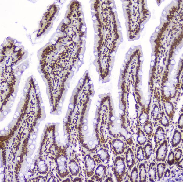 Figure 7. IHC analysis of AHR using anti-AHR antibody (A00225-2). AHR was detected in paraffin-embedded section of rat small intestine tissue. Heat mediated antigen retrieval was performed in citrate buffer (pH6, epitope retrieval solution) for 20 mins. The tissue section was blocked with 10% goat serum. The tissue section was then incubated with 2microg/ml rabbit anti-AHR Antibody (A00225-2) overnight at 4°C. Biotinylated goat anti-rabbit IgG was used as secondary antibody and incubated for 30 minutes at 37°C. The tissue section was developed using Strepavidin-Biotin-Complex (SABC)(Catalog # SA1022) with DAB as the chromogen. Figure 7. IHC analysis of AHR using anti-AHR antibody (A00225-2). AHR was detected in paraffin-embedded section of rat small intestine tissue. Heat mediated antigen retrieval was performed in citrate buffer (pH6, epitope retrieval solution) for 20 mins. The tissue section was blocked with 10% goat serum. The tissue section was then incubated with 2microg/ml rabbit anti-AHR Antibody (A00225-2) overnight at 4°C. Biotinylated goat anti-rabbit IgG was used as secondary antibody and incubated for 30 minutes at 37°C. The tissue section was developed using Strepavidin-Biotin-Complex (SABC)(Catalog # SA1022) with DAB as the chromogen.