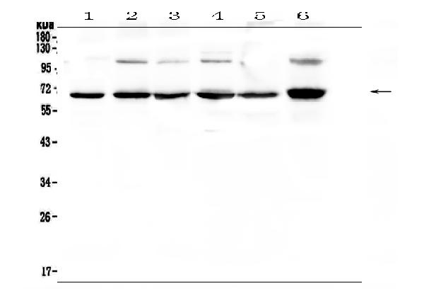 Western blot analysis of NF-kB p65 using anti-NF-kB p65 antibody (A00284-1). Electrophoresis was performed on a 5-20% SDS-PAGE gel at 70V (Stacking gel) / 90V (Resolving gel) for 2-3 hours. The sample well of each lane was loaded with 50ug of sample under reducing conditions. Lane 1: human COLO-320 whole cell lysates, Lane 2: human A549 whole cell lysates, Lane 3: human HepG2 whole cell lysates, Lane 4: human MDA-MB-231 whole cell lysates, Lane 5: human PANC-1 whole cell lysates, Lane 6: human A375 whole cell lysates. After Electrophoresis, proteins were transferred to a Nitrocellulose membrane at 150mA for 50-90 minutes. Blocked the membrane with 5% Non-fat Milk/ TBS for 1.5 hour at RT. The membrane was incubated with rabbit anti-NF-kB p65 antigen affinity purified polyclonal antibody (Catalog # A00284-1) at 0.5 μg/mL overnight at 4℃, then washed with TBS-0.1%Tween 3 times with 5 minutes each and probed with a goat anti-rabbit IgG-HRP secondary antibody at a dilution of 1:10000 for 1.5 hour at RT. The signal is developed using an Enhanced Chemiluminescent detection (ECL) kit (Catalog # EK1002) with Tanon 5200 system. A specific band was detected for NF-kB p65 at approximately 65KD. The expected band size for NF-kB p65 is at 65KD.