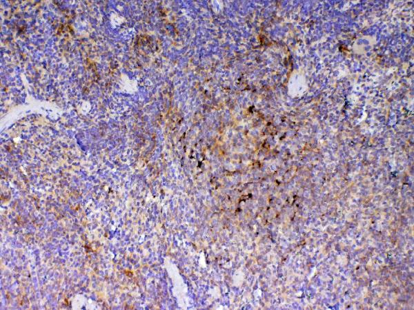 Figure 4. IHC analysis of ICOS using anti-ICOS antibody (A00291-2). ICOS was detected in paraffin-embedded section of rat spleen tissue. Heat mediated antigen retrieval was performed in citrate buffer (pH6, epitope retrieval solution) for 20 mins. The tissue section was blocked with 10% goat serum. The tissue section was then incubated with 1microg/ml rabbit anti-ICOS Antibody (A00291-2) overnight at 4°C. Biotinylated goat anti-rabbit IgG was used as secondary antibody and incubated for 30 minutes at 37°C. The tissue section was developed using Strepavidin-Biotin-Complex (SABC)(Catalog # SA1022) with DAB as the chromogen.