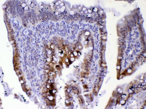 IHC analysis of Cdc20 using anti-Cdc20 antibody (A00382-1). Cdc20 was detected in paraffin-embedded section of rat small intestine tissue. Heat mediated antigen retrieval was performed in citrate buffer (pH6, epitope retrieval solution) for 20 mins. The tissue section was blocked with 10% goat serum. The tissue section was then incubated with 1ug/ml rabbit anti-Cdc20 Antibody (A00382-1) overnight at 4 Biotinylated goat anti-rabbit IgG was used as secondary antibody and incubated for 30 minutes at 37 The tissue section was developed using Strepavidin-Biotin-Complex (SABC)(Catalog # SA1022) with DAB as the chromogen.