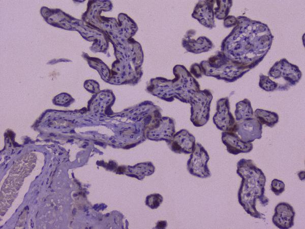 IHC analysis of CIC using anti-CIC antibody (A00385-1). CIC was detected in paraffin-embedded section of human placenta tissue. Heat mediated antigen retrieval was performed in citrate buffer (pH6, epitope retrieval solution) for 20 mins. The tissue section was blocked with 10% goat serum. The tissue section was then incubated with 1μg/ml rabbit anti-CIC Antibody (A00385-1) overnight at 4°C. Biotinylated goat anti-rabbit IgG was used as secondary antibody and incubated for 30 minutes at 37°C. The tissue section was developed using Strepavidin-Biotin-Complex (SABC)(Catalog # SA1022) with DAB as the chromogen.