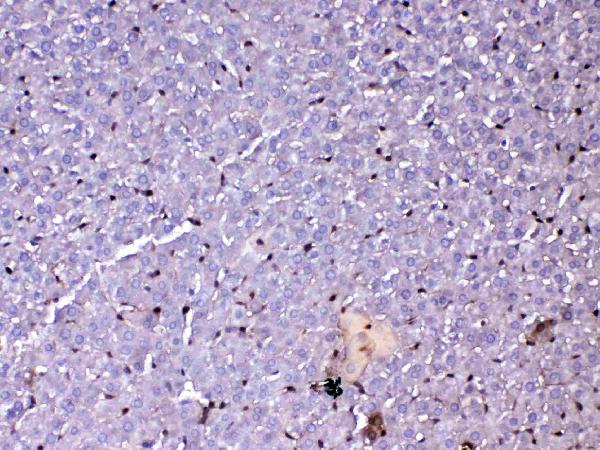 Figure 3. IHC analysis of GST3 / GST pi using anti-GST3 / GST pi antibody (A00394-1). GST3 / GST pi was detected in paraffin-embedded section of rat liver tissue. Heat mediated antigen retrieval was performed in citrate buffer (pH6, epitope retrieval solution) for 20 mins. The tissue section was blocked with 10% goat serum. The tissue section was then incubated with 1ug/ml rabbit anti-GST3 / GST pi Antibody (A00394-1) overnight at 4 Biotinylated goat anti-rabbit IgG was used as secondary antibody and incubated for 30 minutes at 37 The tissue section was developed using Strepavidin-Biotin-Complex (SABC)(Catalog # SA1022) with DAB as the chromogen.