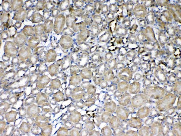  IHC analysis of GST3 / GST pi using anti-GST3 / GST pi antibody (A00394)