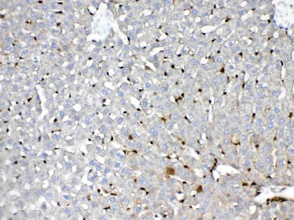 A00394 GST3 primary antibodies IHC testing 5