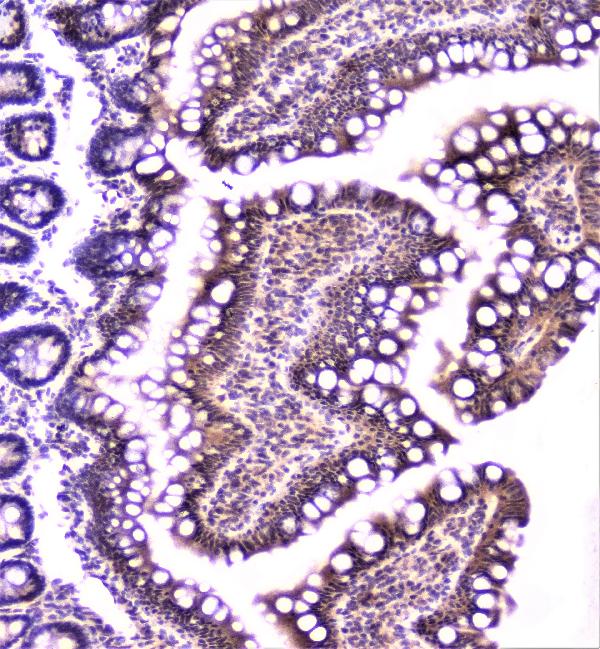 IHC analysis of TANK using anti-TANK antibody (A00445-3). TANK was detected in paraffin-embedded section of rat small intestine tissue. Heat mediated antigen retrieval was performed in citrate buffer (pH6, epitope retrieval solution) for 20 mins. The tissue section was blocked with 10% goat serum. The tissue section was then incubated with 1μg/ml rabbit anti-TANK Antibody (A00445-3) overnight at 4°C. Biotinylated goat anti-rabbit IgG was used as secondary antibody and incubated for 30 minutes at 37°C. The tissue section was developed using Strepavidin-Biotin-Complex (SABC)(Catalog # SA1022) with DAB as the chromogen.