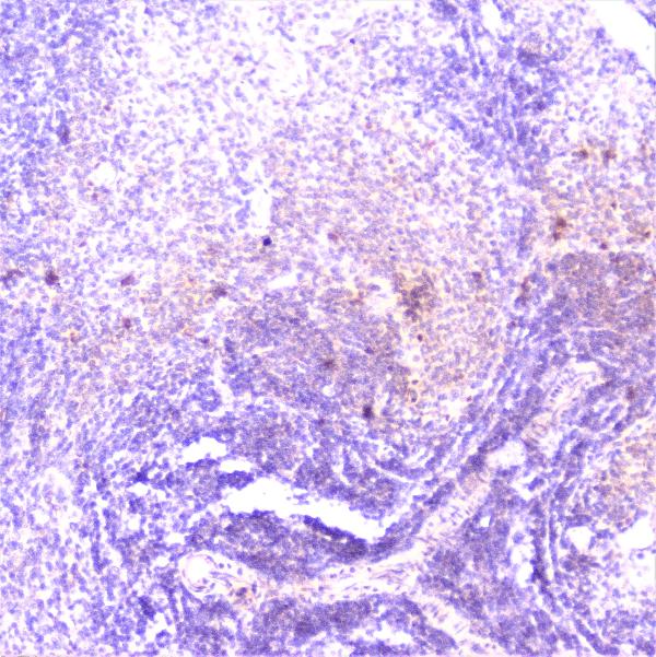 IHC analysis of TANK using anti-TANK antibody (A00445-3). TANK was detected in paraffin-embedded section of rat spleen tissue. Heat mediated antigen retrieval was performed in citrate buffer (pH6, epitope retrieval solution) for 20 mins. The tissue section was blocked with 10% goat serum. The tissue section was then incubated with 1μg/ml rabbit anti-TANK Antibody (A00445-3) overnight at 4°C. Biotinylated goat anti-rabbit IgG was used as secondary antibody and incubated for 30 minutes at 37°C. The tissue section was developed using Strepavidin-Biotin-Complex (SABC)(Catalog # SA1022) with DAB as the chromogen.