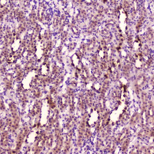 IHC analysis of Leptin using anti-Leptin antibody (A00479-4). Leptin was detected in paraffin-embedded section of rat kidney tissue. Heat mediated antigen retrieval was performed in citrate buffer (pH6, epitope retrieval solution) for 20 mins. The tissue section was blocked with 10% goat serum. The tissue section was then incubated with 2μg/ml rabbit anti-Leptin Antibody (A00479-4) overnight at 4℃. Biotinylated goat anti-rabbit IgG was used as secondary antibody and incubated for 30 minutes at 37℃. The tissue section was developed using Strepavidin-Biotin-Complex (SABC)(Catalog # SA1022) with DAB as the chromogen.