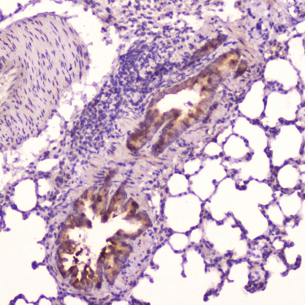 IHC analysis of Leptin using anti-Leptin antibody (A00479-4). Leptin was detected in paraffin-embedded section of rat lung tissue. Heat mediated antigen retrieval was performed in citrate buffer (pH6, epitope retrieval solution) for 20 mins. The tissue section was blocked with 10% goat serum. The tissue section was then incubated with 2μg/ml rabbit anti-Leptin Antibody (A00479-4) overnight at 4°C. Biotinylated goat anti-rabbit IgG was used as secondary antibody and incubated for 30 minutes at 37°C. The tissue section was developed using Strepavidin-Biotin-Complex (SABC)(Catalog # SA1022) with DAB as the chromogen.