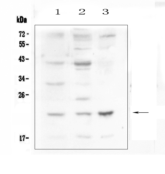 Western blot analysis of Leptin using anti-Leptin antibody (A00479-4). Electrophoresis was performed on a 5-20% SDS-PAGE gel at 70V (Stacking gel) / 90V (Resolving gel) for 2-3 hours. The sample well of each lane was loaded with 50ug of sample under reducing conditions. Lane 1: mouse small intestine tissue lysates, Lane 2: mouse kidney tissue lysates, Lane 3: mouse Neuro-2a whole cell lysates. After Electrophoresis, proteins were transferred to a Nitrocellulose membrane at 150mA for 50-90 minutes. Blocked the membrane with 5% Non-fat Milk/ TBS for 1.5 hour at RT. The membrane was incubated with rabbit anti-Leptin antigen affinity purified polyclonal antibody (Catalog # A00479-4) at 0.5 μg/mL overnight at 4℃, then washed with TBS-0.1%Tween 3 times with 5 minutes each and probed with a goat anti-rabbit IgG-HRP secondary antibody at a dilution of 1:10000 for 1.5 hour at RT. The signal is developed using an Enhanced Chemiluminescent detection (ECL) kit (Catalog # EK1002) with Tanon 5200 system. A specific band was detected for Leptin at approximately 23KD. The expected band size for Leptin is at 18KD.