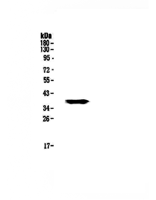 Western blot analysis of GALE using anti-GALE antibody (A00551-1).