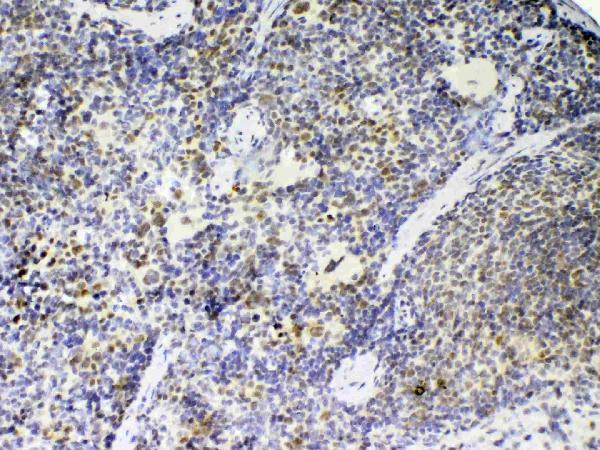 A00581 1 PTPN22 primary antibodies IHC testing 2