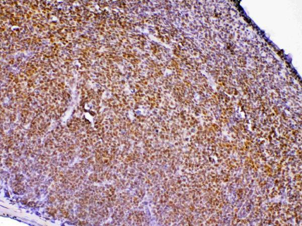 A00581 1 PTPN22 primary antibodies IHC testing 3