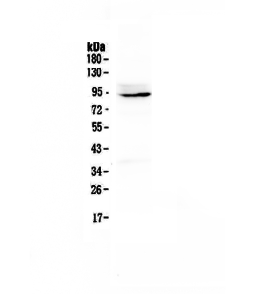 A00581 1 PTPN22 primary antibodies WB testing 1