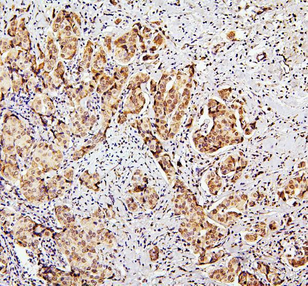 A00583 1 SUZ12 primary antibodies IHC testing 2