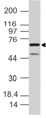 Western blot analysis of SAMHD1
