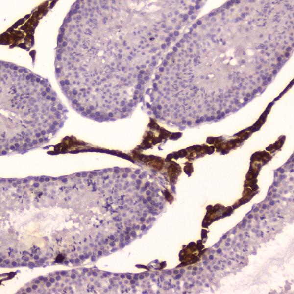 A00615 3 Cyp17a1 primary antibodies IHC testing 2_1