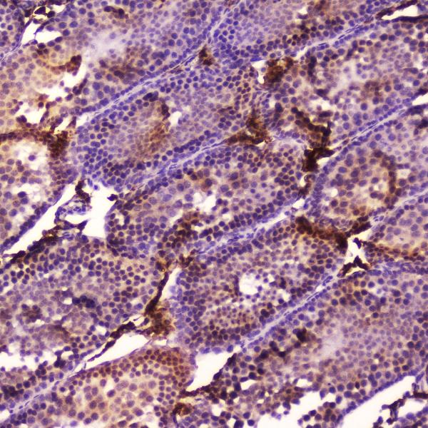 IHC analysis of Cyp17a1 using anti-Cyp17a1 antibody (A00615-3). Cyp17a1 was detected in paraffin-embedded section of rat testis tissue. Heat mediated antigen retrieval was performed in citrate buffer (pH6, epitope retrieval solution) for 20 mins. The tissue section was blocked with 10% goat serum. The tissue section was then incubated with 2μg/ml rabbit anti-Cyp17a1 Antibody (A00615-3) overnight at 4℃. Biotinylated goat anti-rabbit IgG was used as secondary antibody and incubated for 30 minutes at 37℃. The tissue section was developed using Strepavidin-Biotin-Complex (SABC)(Catalog # SA1022) with DAB as the chromogen.