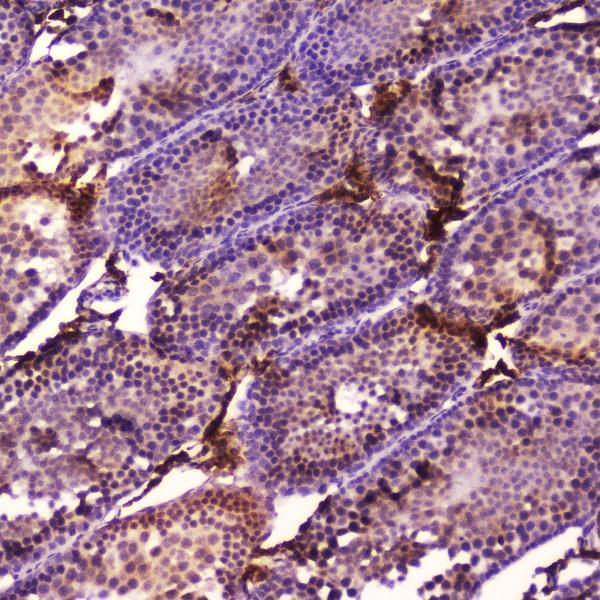A00615 3 Cyp17a1 primary antibodies IHC testing 3_1