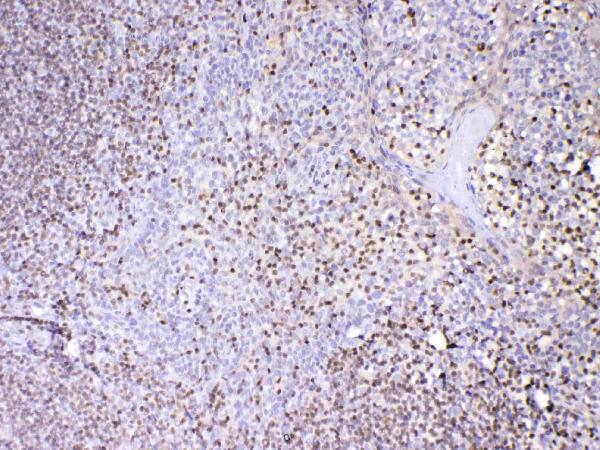 Figure 2. IHC analysis of PAX5 using anti-PAX5 antibody (A00669-1). PAX5 was detected in paraffin-embedded section of human tonsil tissue. Heat mediated antigen retrieval was performed in citrate buffer (pH6, epitope retrieval solution) for 20 mins. The tissue section was blocked with 10% goat serum. The tissue section was then incubated with 1microg/ml rabbit anti-PAX5 Antibody (A00669-1) overnight at 4°C. Biotinylated goat anti-rabbit IgG was used as secondary antibody and incubated for 30 minutes at 37°C. The tissue section was developed using Strepavidin-Biotin-Complex (SABC)(Catalog # SA1022) with DAB as the chromogen.