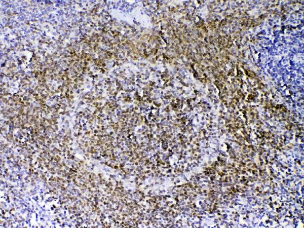 Figure 4. IHC analysis of PAX5 using anti-PAX5 antibody (A00669-1). PAX5 was detected in paraffin-embedded section of rat spleen tissue. Heat mediated antigen retrieval was performed in citrate buffer (pH6, epitope retrieval solution) for 20 mins. The tissue section was blocked with 10% goat serum. The tissue section was then incubated with 1microg/ml rabbit anti-PAX5 Antibody (A00669-1) overnight at 4°C. Biotinylated goat anti-rabbit IgG was used as secondary antibody and incubated for 30 minutes at 37°C. The tissue section was developed using Strepavidin-Biotin-Complex (SABC)(Catalog # SA1022) with DAB as the chromogen.