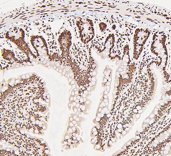  IHC analysis of DDX5 using anti-DDX5 antibody (A00670)
