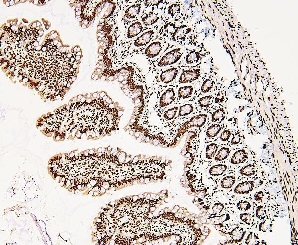 A00670 DDX5 primary antibodies IHC testing 4