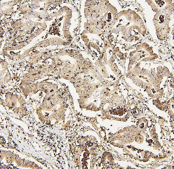 A00670 DDX5 primary antibodies IHC testing 5