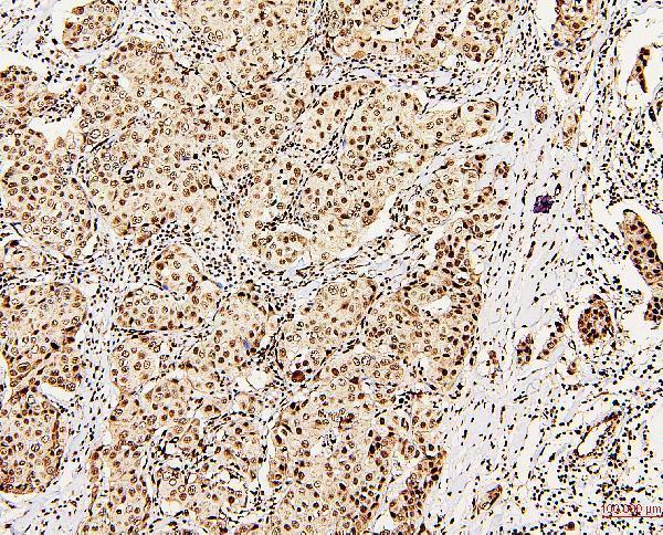 A00670 DDX5 primary antibodies IHC testing 6