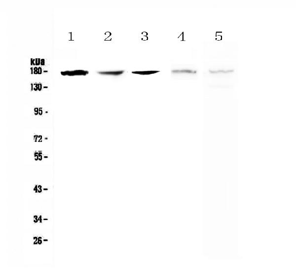 Figure 1. Western blot analysis of IRE1 using anti-IRE1 antibody (A00683-1). Electrophoresis was performed on a 5-20% SDS-PAGE gel at 70V (Stacking gel) / 90V (Resolving gel) for 2-3 hours. The sample well of each lane was loaded with 50ug of sample under reducing conditions. Lane 1: human A549 whole cell lysates, Lane 2: human SK-OV-3 whole cell lysates, Lane 3: human PANC-1 whole cell lysates, Lane 4: rat brain tissue lysates, Lane 5: mouse brain tissue lysates. After Electrophoresis, proteins were transferred to a Nitrocellulose membrane at 150mA for 50-90 minutes. Blocked the membrane with 5% Non-fat Milk/ TBS for 1.5 hour at RT. The membrane was incubated with rabbit anti-IRE1 antigen affinity purified polyclonal antibody (Catalog # A00683-1) at 0.5 microg/mL overnight at 4°C, then washed with TBS-0.1%Tween 3 times with 5 minutes each and probed with a goat anti-rabbit IgG-HRP secondary antibody at a dilution of 1:10000 for 1.5 hour at RT. The signal is developed using an Enhanced Chemiluminescent detection (ECL) kit (Catalog # EK1002) with Tanon 5200 system. A specific band was detected for IRE1 at approximately 170KD. The expected band size for IRE1 is at 110KD.