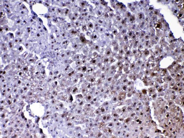  IHC analysis of PARK7 / DJ1 using anti-PARK7 / DJ1 antibody (A00757-2)