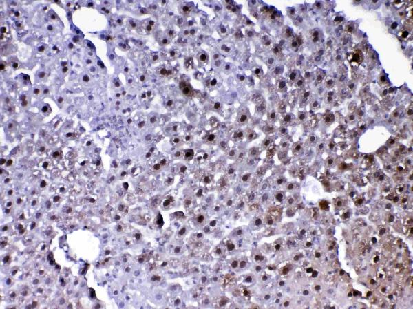 IHC analysis of PARK7 / DJ1 using anti-PARK7 / DJ1 antibody (A00757-2). PARK7 / DJ1 was detected in paraffin-embedded section of mouse liver tissue. Heat mediated antigen retrieval was performed in citrate buffer (pH6, epitope retrieval solution) for 20 mins. The tissue section was blocked with 10% goat serum. The tissue section was then incubated with 1ug/ml rabbit anti-PARK7 / DJ1 Antibody (A00757-2) overnight at 4 Biotinylated goat anti-rabbit IgG was used as secondary antibody and incubated for 30 minutes at 37 The tissue section was developed using Strepavidin-Biotin-Complex (SABC)(Catalog # SA1022) with DAB as the chromogen.