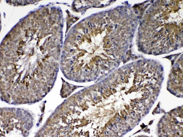 A00757 2 PARK7 primary antibodies IHC testing 4