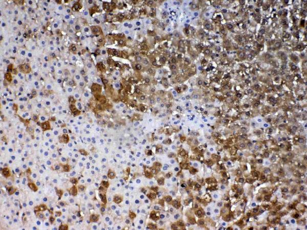 IHC analysis of PARK7 / DJ1 using anti-PARK7 / DJ1 antibody (A00757-2). PARK7 / DJ1 was detected in paraffin-embedded section of rat liver tissue. Heat mediated antigen retrieval was performed in citrate buffer (pH6, epitope retrieval solution) for 20 mins. The tissue section was blocked with 10% goat serum. The tissue section was then incubated with 1ug/ml rabbit anti-PARK7 / DJ1 Antibody (A00757-2) overnight at 4 Biotinylated goat anti-rabbit IgG was used as secondary antibody and incubated for 30 minutes at 37 The tissue section was developed using Strepavidin-Biotin-Complex (SABC)(Catalog # SA1022) with DAB as the chromogen.