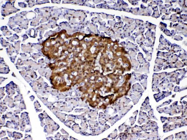 A00757 2 PARK7 primary antibodies IHC testing 6