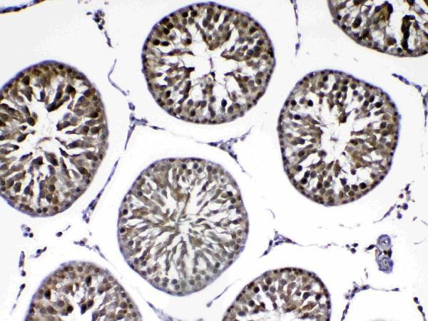 A00757 2 PARK7 primary antibodies IHC testing 7