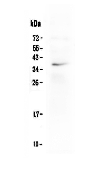 Western blot analysis of LOX-1/OLR1 using anti-LOX-1/OLR1 antibody (A00760-1).
