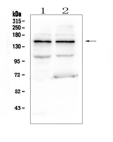 Figure 1. Western blot analysis of KCNH2 using anti-KCNH2 antibody (A00781-1). Electrophoresis was performed on a 5-20% SDS-PAGE gel at 70V (Stacking gel) / 90V (Resolving gel) for 2-3 hours. The sample well of each lane was loaded with 50ug of sample under reducing conditions. Lane 1: human K562 whole cell lysates Lane 2: human U2OS whole cell lysates After Electrophoresis, proteins were transferred to a Nitrocellulose membrane at 150mA for 50-90 minutes. Blocked the membrane with 5% Non-fat Milk/ TBS for 1.5 hour at RT. The membrane was incubated with rabbit anti-KCNH2 antigen affinity purified polyclonal antibody (Catalog # A00781-1) at 0.5 microg/mL overnight at 4°C, then washed with TBS-0.1%Tween 3 times with 5 minutes each and probed with a goat anti-rabbit IgG-HRP secondary antibody at a dilution of 1:10000 for 1.5 hour at RT. The signal is developed using an Enhanced Chemiluminescent detection (ECL) kit (Catalog # EK1002) with Tanon 5200 system. A specific band was detected for KCNH2 at approximately 150KD. The expected band size for KCNH2 is at 127KD.