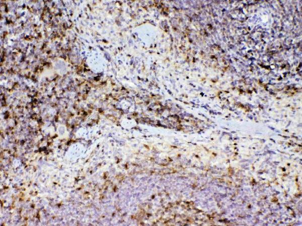 A00866 1 ADA primary antibodies IHC testing 4