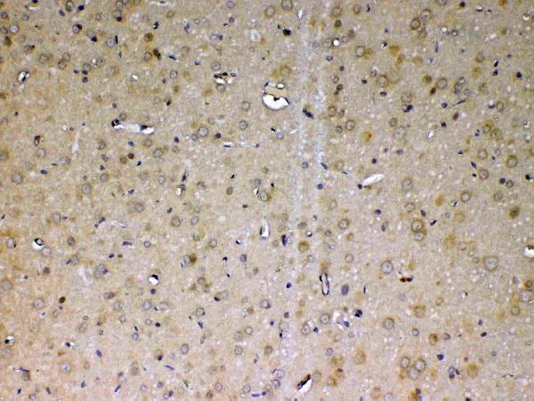 A00866 1 ADA primary antibodies IHC testing 5