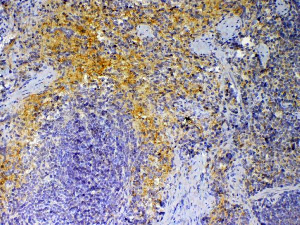 Figure 2. IHC analysis of PF4 using anti-PF4 antibody (A00871). PF4 was detected in paraffin-embedded section of mouse spleen tissue. Heat mediated antigen retrieval was performed in citrate buffer (pH6, epitope retrieval solution) for 20 mins. The tissue section was blocked with 10% goat serum. The tissue section was then incubated with 1microg/ml rabbit anti-PF4 Antibody (A00871) overnight at 4°C. Biotinylated goat anti-rabbit IgG was used as secondary antibody and incubated for 30 minutes at 37°C. The tissue section was developed using Strepavidin-Biotin-Complex (SABC)(Catalog # SA1022) with DAB as the chromogen.