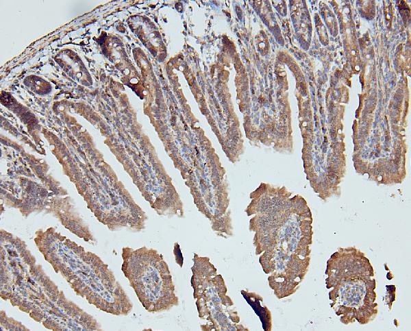 Figure 3. IHC analysis of DDR1 using anti-DDR1 antibody (A00905). DDR1 was detected in paraffin-embedded section of mouse intestine tissues. Heat mediated antigen retrieval was performed in citrate buffer (pH6, epitope retrieval solution) for 20 mins. The tissue section was blocked with 10% goat serum. The tissue section was then incubated with 1microg/ml rabbit anti-DDR1 Antibody (A00905) overnight at 4°C. Biotinylated goat anti-rabbit IgG was used as secondary antibody and incubated for 30 minutes at 37°C. The tissue section was developed using Strepavidin-Biotin-Complex (SABC)(Catalog # SA1022) with DAB as the chromogen.