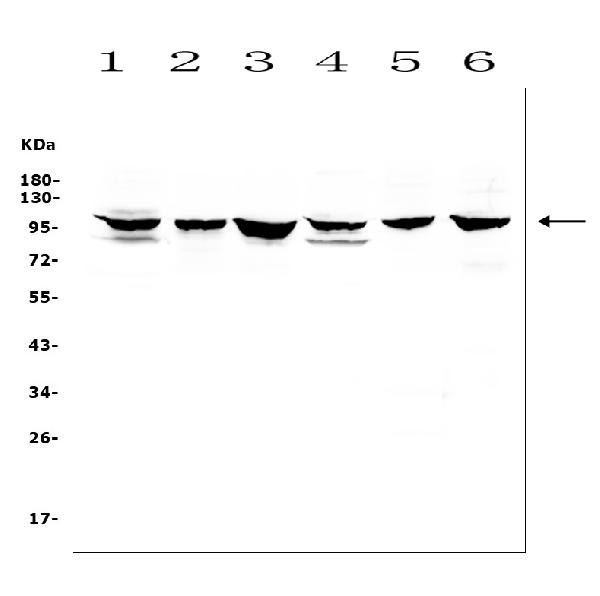 Figure 2. Western blot analysis of DDR1 using anti-DDR1 antibody (A00905). Electrophoresis was performed on a 5-20% SDS-PAGE gel at 70V (Stacking gel) / 90V (Resolving gel) for 2-3 hours. The sample well of each lane was loaded with 50ug of sample under reducing conditions. Lane 1: rat brain tissue lysates, Lane 2: rat lung tissue lysates, Lane 3: rat testicular tissue lysates, Lane 4: mouse brain tissue lysates, Lane 5: mouse lung tissue lysates, Lane 6: mouse testicular tissue lysates. After Electrophoresis, proteins were transferred to a Nitrocellulose membrane at 150mA for 50-90 minutes. Blocked the membrane with 5% Non-fat Milk/ TBS for 1.5 hour at RT. The membrane was incubated with rabbit anti-DDR1 antigen affinity purified polyclonal antibody (Catalog # A00905) at 0.5 microg/mL overnight at 4°C, then washed with TBS-0.1%Tween 3 times with 5 minutes each and probed with a goat anti-rabbit IgG-HRP secondary antibody at a dilution of 1:10000 for 1.5 hour at RT. The signal is developed using an Enhanced Chemiluminescent detection (ECL) kit (Catalog # EK1002) with Tanon 5200 system. A specific band was detected for DDR1 at approximately 101KD. The expected band size for DDR1 is at 101KD.